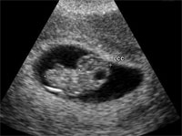 embryo-scan