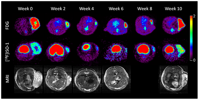 PET_scans_of_brain_tumor_using_Sigma-2_Ligands