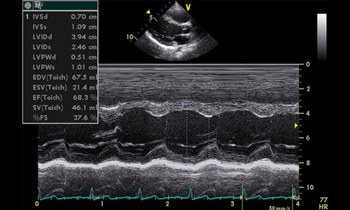 ECG-and-Echocardiography