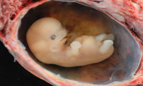 640px-Human_Embryo_-_Approximately_8_weeks_estimated_gestational_age