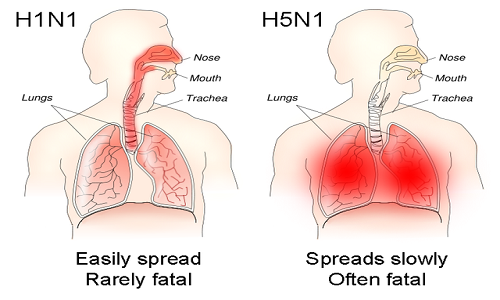 640px-H1N1_versus_H5N1_pathology