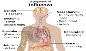549px-Symptoms_of_influenza.svg