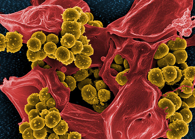 Difference Between Methicillin-Resistant Staphylococcus aureus And Staphylococcus aureus