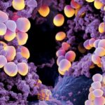 Methicillin-Resistant Staphylococcus aureus versus Staphylococcus aureus-1