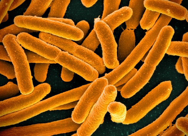 Difference Between E. Coli and Klebsiella