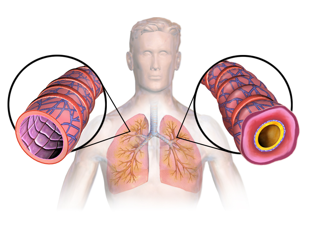 Difference Between Asthma and Reactive Airway Disease
