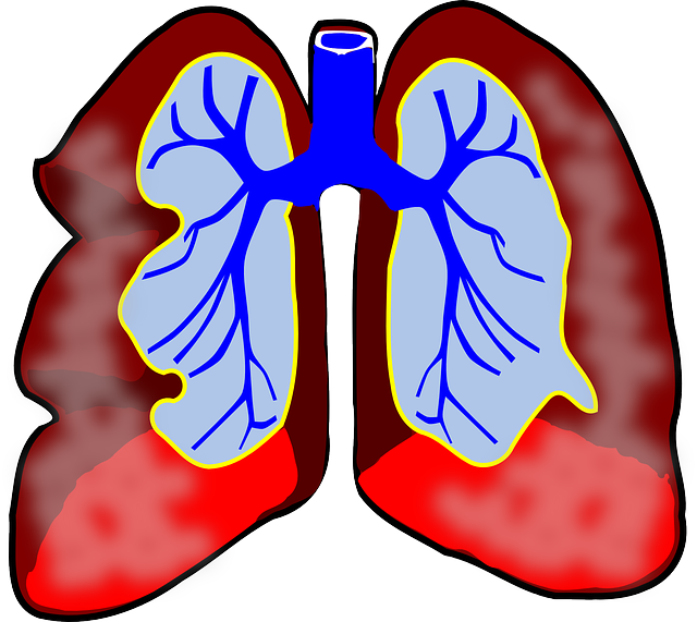 Difference Between Pneumonia and Lung Infection.