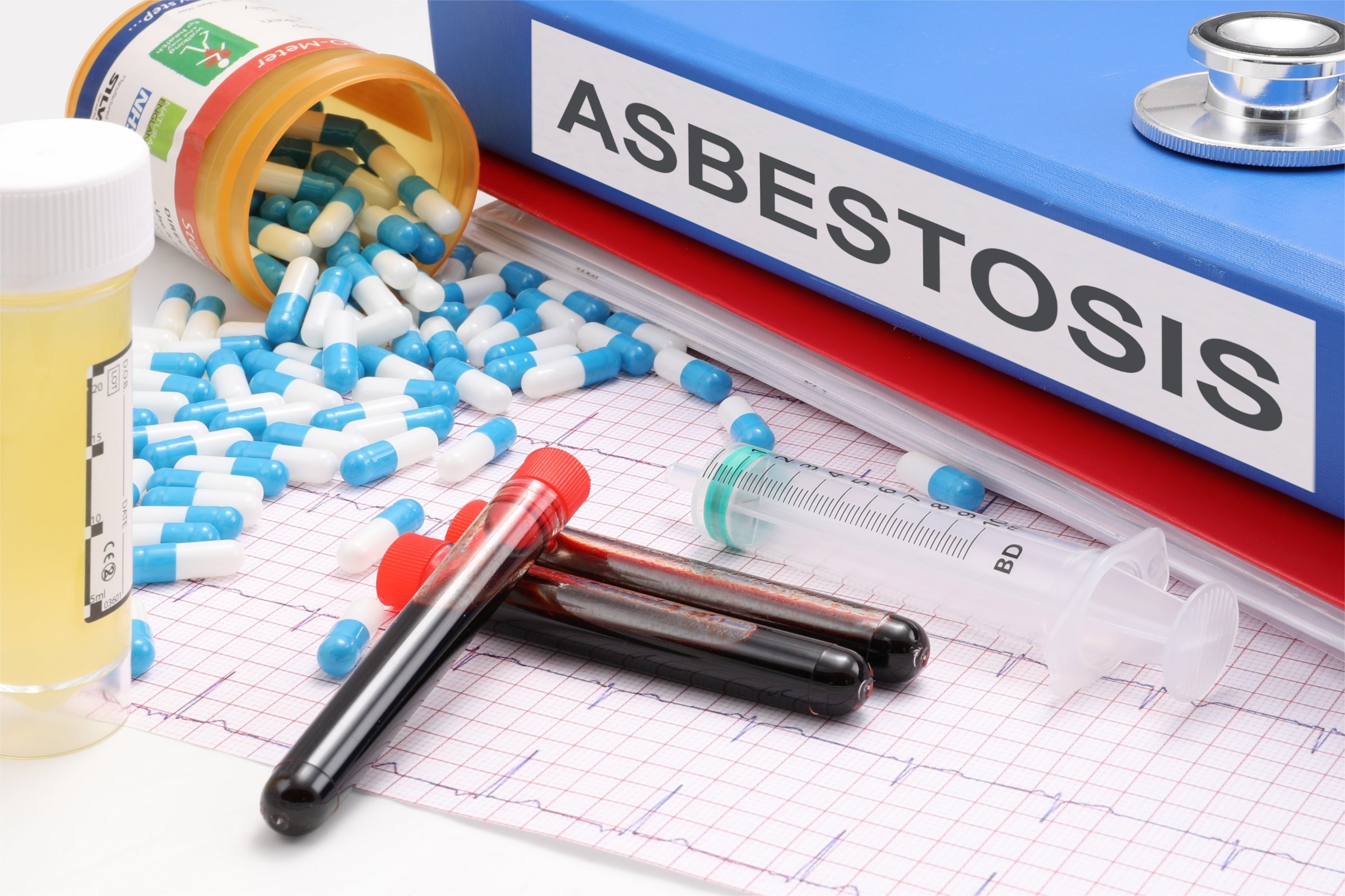 Difference Between Asbestosis and Chronic Obstructive Pulmonary Disease (COPD)