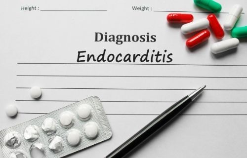 Difference Between Pericarditis and Endocarditis