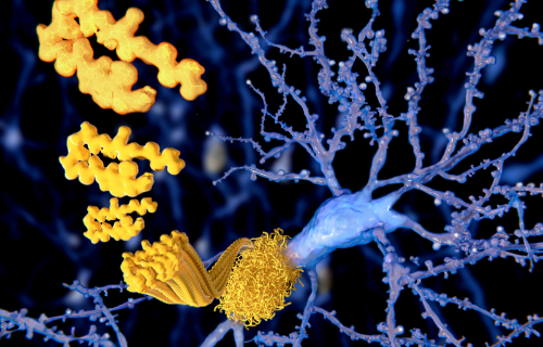 Difference Between Amyloid and Prion