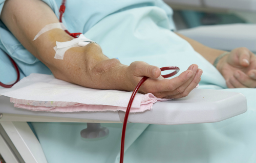 Difference Between Haemodialysis and Peritoneal Dialysis
