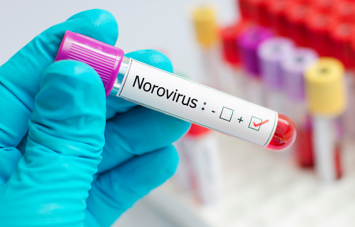 Difference Between Norovirus and Norwalk