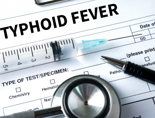 Difference Between Malaria and Typhoid Symptoms (1)