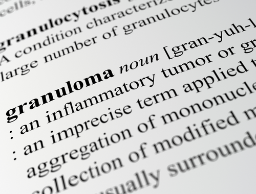 Difference between Caseating and Noncaseating Granuloma (1)