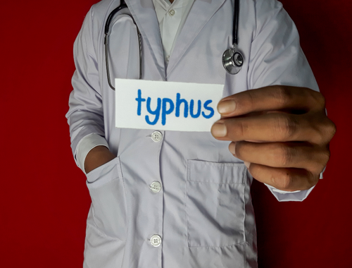 Difference Between Typhoid and Typhus (1)