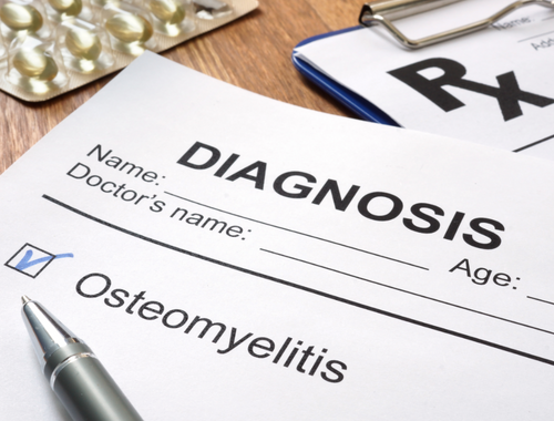 Difference Between Acute and Chronic Osteomyelitis