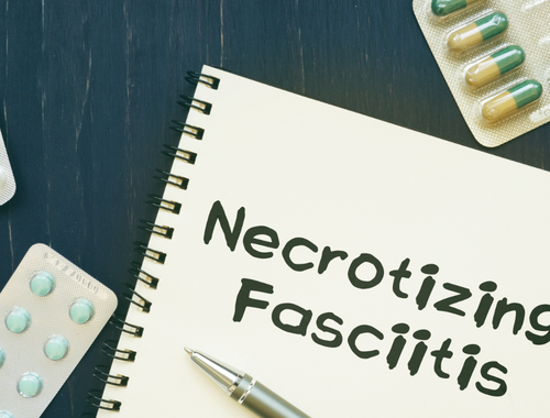 Difference Between Fournier's Gangrene and Necrotizing Fasciitis (1)