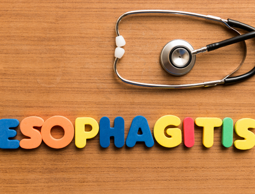 Difference Between Gastritis and Esophagitis