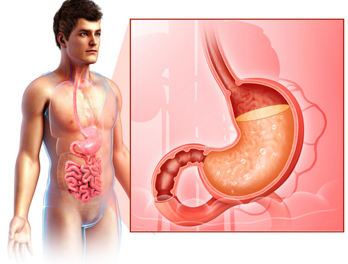 Difference Between Normal Stomach and Gastritis