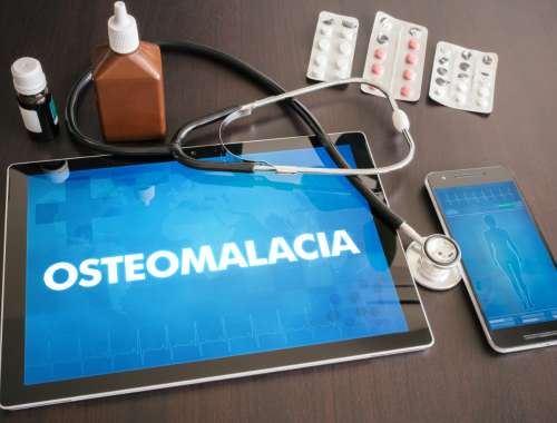 Difference Between Osteomyelitis and Osteomalacia