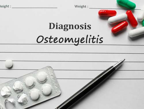 Difference Between Osteoporosis and Osteomyelitis