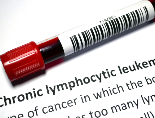 Difference Between Chronic Lymphocytic Leukemia and Acute Lymphoblastic Leukemia (1)
