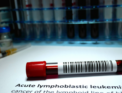 Difference Between Chronic Lymphocytic Leukemia and Acute Lymphoblastic Leukemia