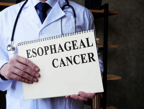 Difference Between Esophageal Cancer and Stomach Cancer (1)
