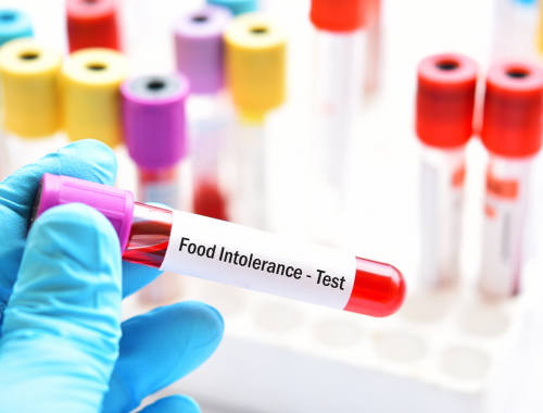 Difference Between Food Allergies and Food Intolerances