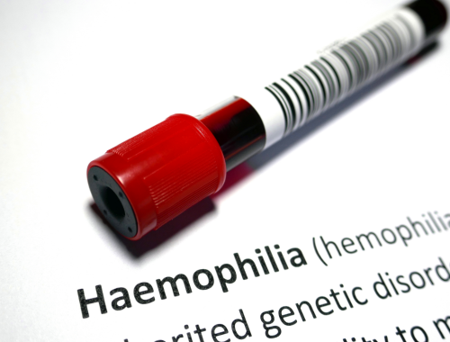 Difference Between Hemophilia A and Hemophilia B