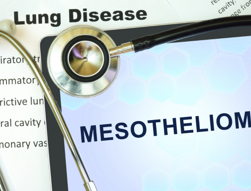 Difference Between Mesothelioma and Lung Cancer (1)