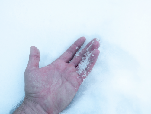 Difference Between Raynaud’s Disease and Frostbite (1)