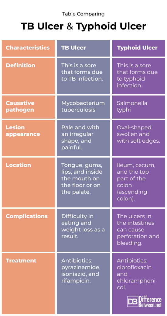 TB Ulcer and Typhoid Ulcer