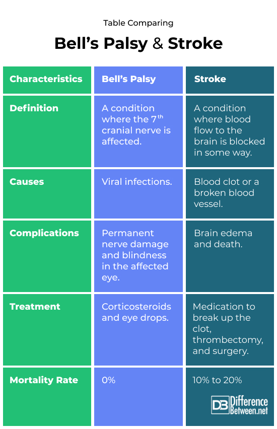 Bell palsy and Stroke