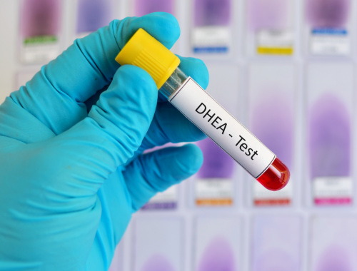 Difference Between 7 Keto DHEA and DHEA