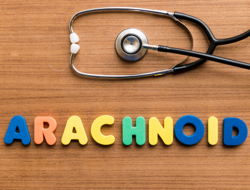 Difference Between Arachnoiditis and Sciatica (1)