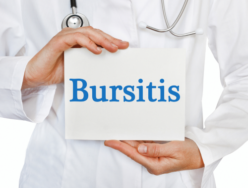 Difference Between Sciatica and Bursitis